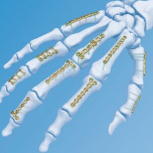 Sistema de mano modular