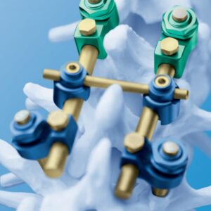 sistema uss fracturas